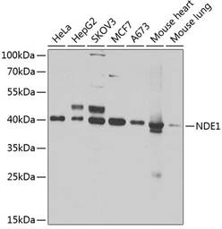 Anti-NDE1 antibody used in Western Blot (WB). GTX33347
