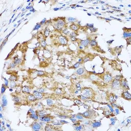 Anti-NDE1 antibody used in IHC (Paraffin sections) (IHC-P). GTX33347