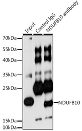 Anti-NDUFB10 antibody used in Immunoprecipitation (IP). GTX33350