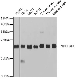 Anti-NDUFB10 antibody used in Western Blot (WB). GTX33350