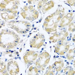Anti-NDUFB10 antibody used in IHC (Paraffin sections) (IHC-P). GTX33350