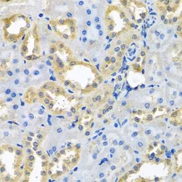 Anti-NDUFB10 antibody used in IHC (Paraffin sections) (IHC-P). GTX33350