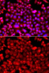 Anti-NDUFV1 antibody used in Immunocytochemistry/ Immunofluorescence (ICC/IF). GTX33351
