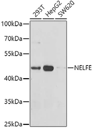 Anti-NELF-E antibody used in Western Blot (WB). GTX33353