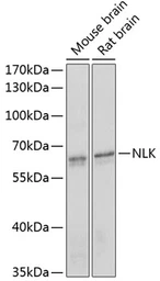 Anti-NLK antibody used in Western Blot (WB). GTX33359