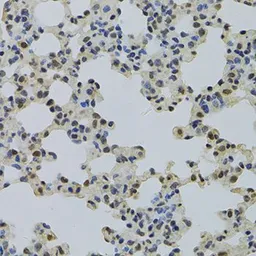 Anti-NLK antibody used in IHC (Paraffin sections) (IHC-P). GTX33359