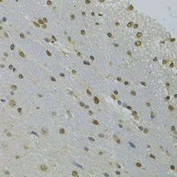 Anti-NLK antibody used in IHC (Paraffin sections) (IHC-P). GTX33359