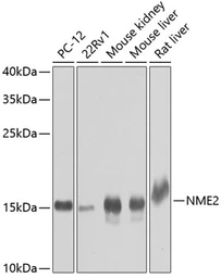 Anti-nm23-H2 antibody used in Western Blot (WB). GTX33360