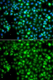 Anti-nm23-H2 antibody used in Immunocytochemistry/ Immunofluorescence (ICC/IF). GTX33360