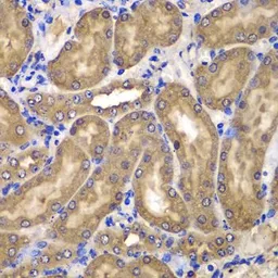 Anti-nm23-H2 antibody used in IHC (Paraffin sections) (IHC-P). GTX33360