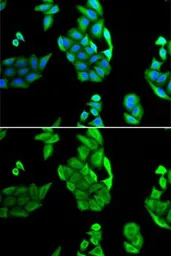 Anti-NOL3 antibody used in Immunocytochemistry/ Immunofluorescence (ICC/IF). GTX33361