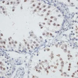 Anti-NOL3 antibody used in IHC (Paraffin sections) (IHC-P). GTX33361