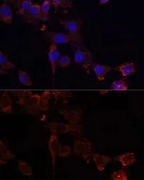 Anti-NRF1 antibody used in Immunocytochemistry/ Immunofluorescence (ICC/IF). GTX33367