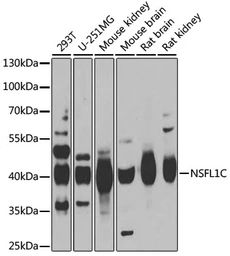 Anti-NSFL1C antibody used in Western Blot (WB). GTX33368