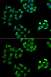 Anti-NSFL1C antibody used in Immunocytochemistry/ Immunofluorescence (ICC/IF). GTX33368