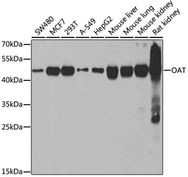 Anti-OAT antibody used in Western Blot (WB). GTX33373