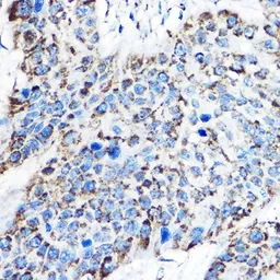 Anti-OAT antibody used in IHC (Paraffin sections) (IHC-P). GTX33373