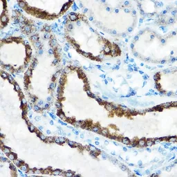 Anti-OAT antibody used in IHC (Paraffin sections) (IHC-P). GTX33373