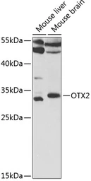 Anti-OTX2 antibody used in Western Blot (WB). GTX33377
