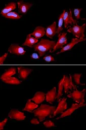 Anti-p120 Catenin antibody used in Immunocytochemistry/ Immunofluorescence (ICC/IF). GTX33378