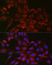 Anti-P4HA2 antibody used in Immunocytochemistry/ Immunofluorescence (ICC/IF). GTX33379