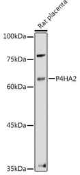 Anti-P4HA2 antibody used in Western Blot (WB). GTX33379