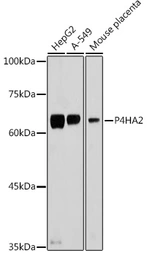 Anti-P4HA2 antibody used in Western Blot (WB). GTX33379