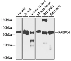 Anti-PABPC4 antibody used in Western Blot (WB). GTX33380