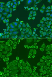 Anti-PABPC4 antibody used in Immunocytochemistry/ Immunofluorescence (ICC/IF). GTX33380