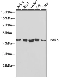 Anti-PAICS antibody used in Western Blot (WB). GTX33382