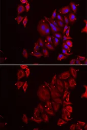 Anti-PAICS antibody used in Immunocytochemistry/ Immunofluorescence (ICC/IF). GTX33382