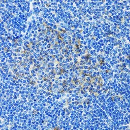 Anti-PAICS antibody used in IHC (Paraffin sections) (IHC-P). GTX33382