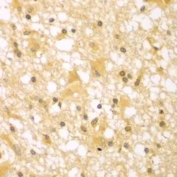 Anti-PAK6 antibody used in IHC (Paraffin sections) (IHC-P). GTX33383