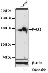 Anti-PARP antibody used in Western Blot (WB). GTX33387