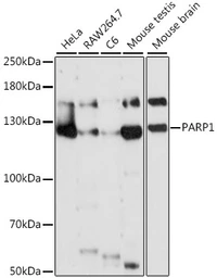 Anti-PARP antibody used in Western Blot (WB). GTX33387