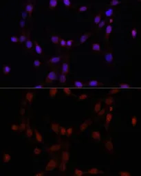 Anti-PARP antibody used in Immunocytochemistry/ Immunofluorescence (ICC/IF). GTX33387