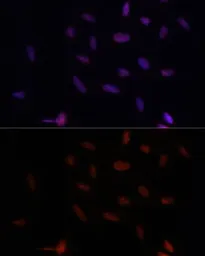 Anti-PARP antibody used in Immunocytochemistry/ Immunofluorescence (ICC/IF). GTX33387