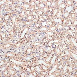 Anti-PARP antibody used in IHC (Paraffin sections) (IHC-P). GTX33387