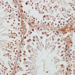 Anti-PARP antibody used in IHC (Paraffin sections) (IHC-P). GTX33387