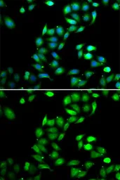 Anti-PDCD6 antibody used in Immunocytochemistry/ Immunofluorescence (ICC/IF). GTX33394
