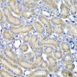 Anti-PDCD6 antibody used in IHC (Paraffin sections) (IHC-P). GTX33394
