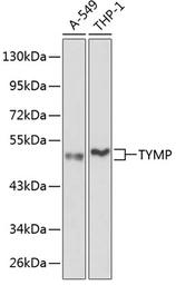 Anti-Thymidine Phosphorylase antibody used in Western Blot (WB). GTX33396