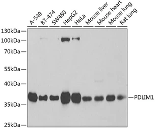 Anti-PDLIM1 antibody used in Western Blot (WB). GTX33399