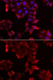 Anti-PDLIM1 antibody used in Immunocytochemistry/ Immunofluorescence (ICC/IF). GTX33399