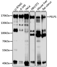 Anti-PELP1 antibody used in Western Blot (WB). GTX33402