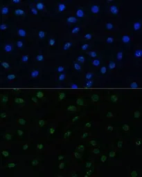Anti-PELP1 antibody used in Immunocytochemistry/ Immunofluorescence (ICC/IF). GTX33402