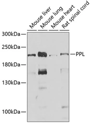 Anti-Periplakin antibody used in Western Blot (WB). GTX33403