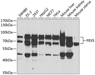 Anti-PEX5 antibody used in Western Blot (WB). GTX33404