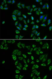 Anti-PEX5 antibody used in Immunocytochemistry/ Immunofluorescence (ICC/IF). GTX33404