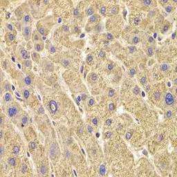 Anti-PEX5 antibody used in IHC (Paraffin sections) (IHC-P). GTX33404